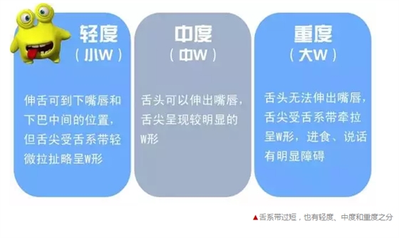 寶寶說話不清楚，是舌系帶惹的禍？