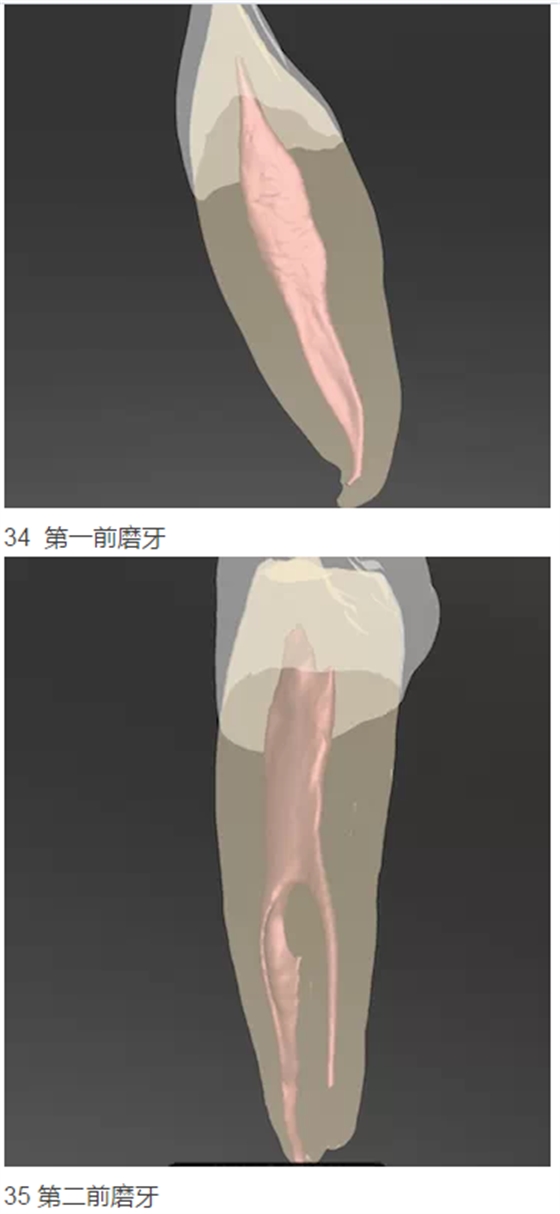 215.png 215.png