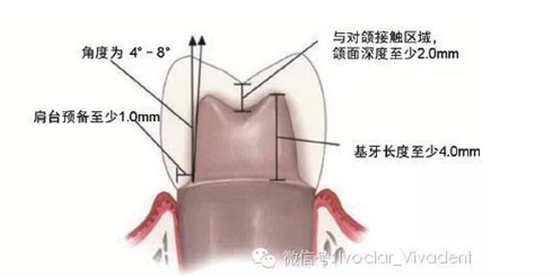 時常搞不清楚怎么備牙嗎？義獲嘉教您如何完美備牙