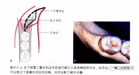 分析局部麻醉失敗的常見(jiàn)原因