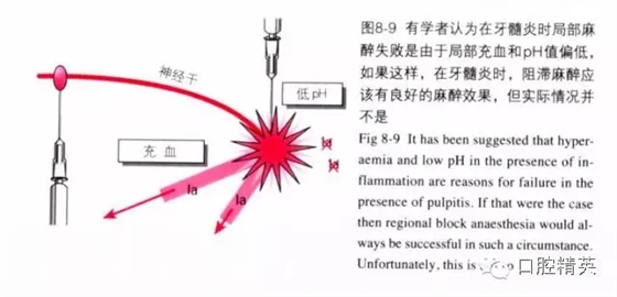 分析局部麻醉失敗的常見(jiàn)原因