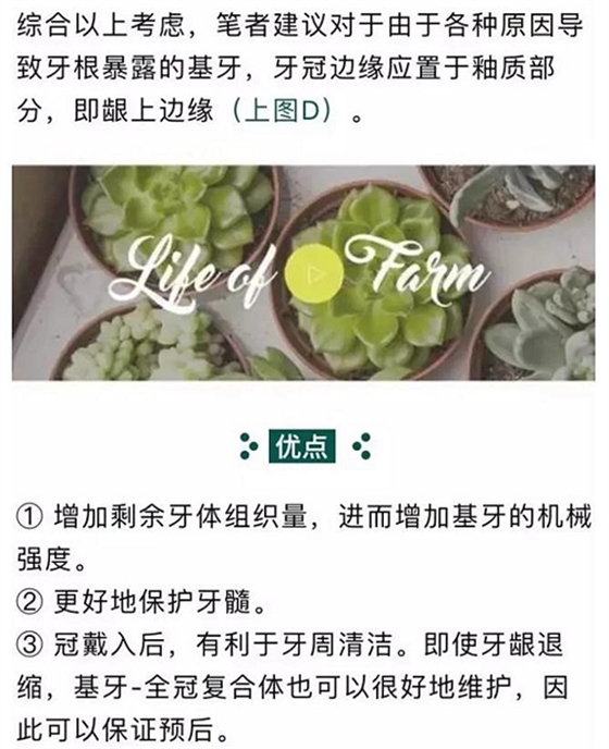 做全冠修復時基牙根面暴露，如何備牙？