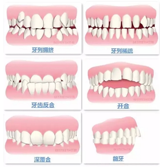 【口腔科普】關于矯牙前、中、后需要注意的問題，了解一下？