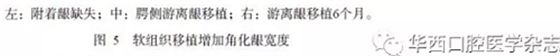 【專家共識(shí)】種植修復(fù)臨床評(píng)價(jià)標(biāo)準(zhǔn)
