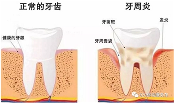 牙齦萎縮怎么辦？