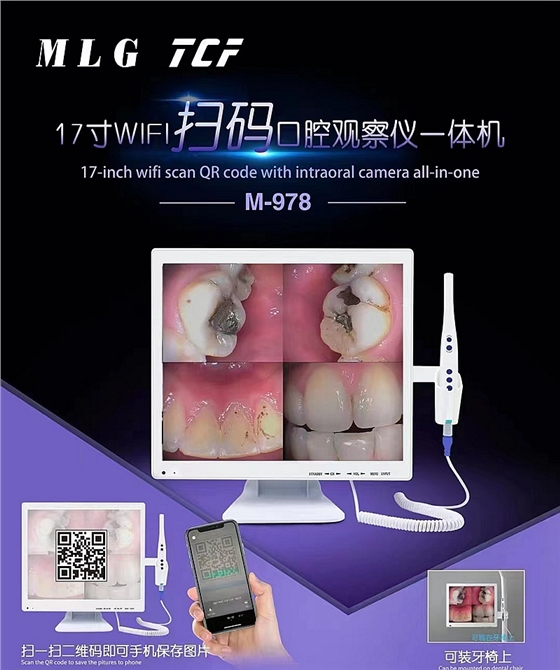 美力光內窺鏡 美力光內窺鏡