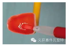 義獲嘉貼面粘接的操作步驟！