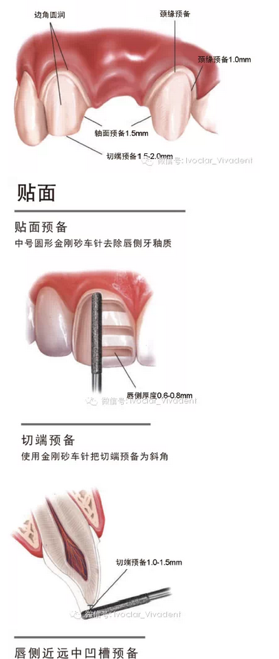 時(shí)常搞不清楚怎么備牙嗎？義獲嘉教您如何完美備牙