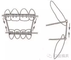 口腔醫(yī)學主治醫(yī)師筆試-精講強化-齲病牙體硬組織牙髓病和根尖周