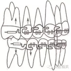 口腔醫(yī)學主治醫(yī)師筆試-精講強化-齲病牙體硬組織牙髓病和根尖周