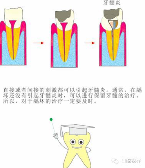 【愛牙科普知識300問】 “什么是融合牙、愈合牙和雙生牙？”