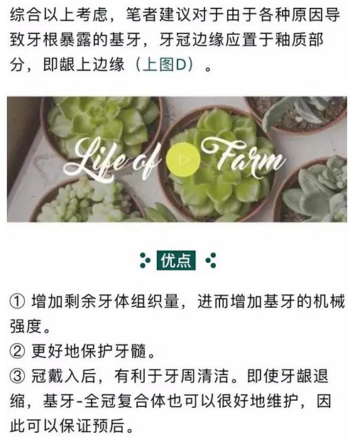 做全冠修復(fù)時(shí)基牙根面暴露，如何備牙？