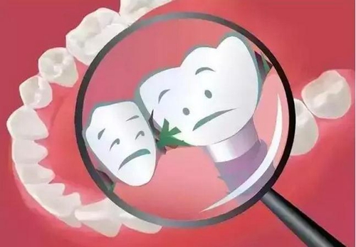 為什么吃東西老塞牙?小心這些??! 為什么吃東西老塞牙?小心這些病!
