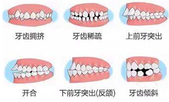 關于牙齒矯正，你想知道的都在這！