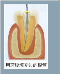 多頻技術(shù)的根管長(zhǎng)度測(cè)定儀