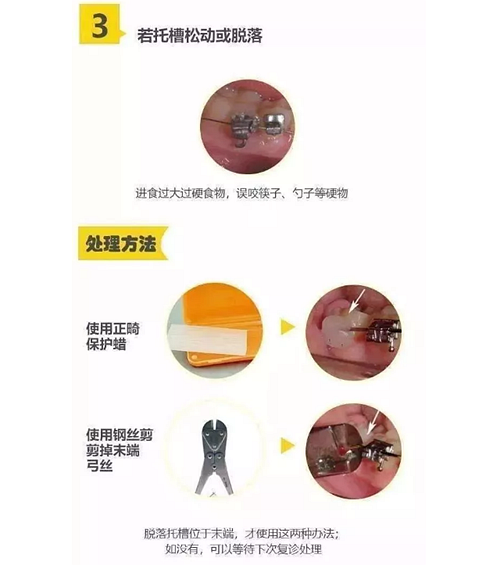 特殊時(shí)期為什么常規(guī)的口腔治療都不能做了？