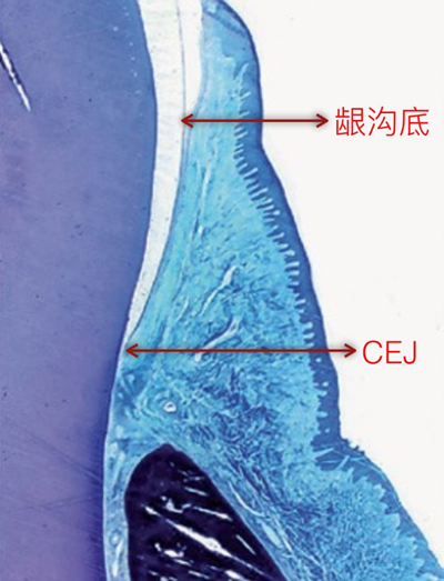 牙周解剖（一）：角化齦和附著齦爭議總結(jié)